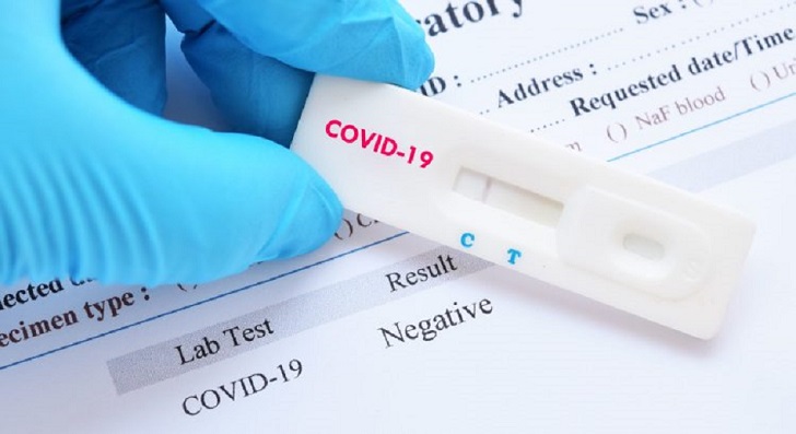 UnionGC solicita que los compañeros positivos por coronavirus, no trabajen hasta habérseles practicado una prueba negativa